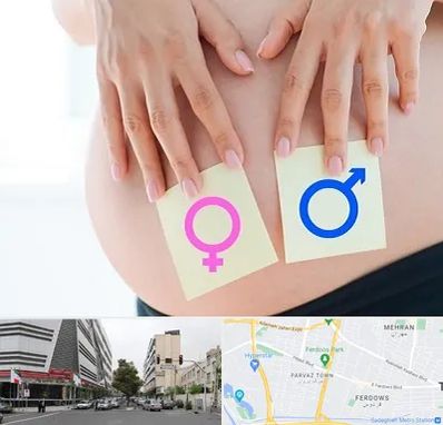 کلینیک تعیین جنسیت در بلوار فردوس 