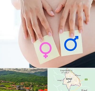 کلینیک تعیین جنسیت در آمل