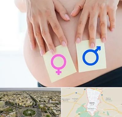 کلینیک تعیین جنسیت در قزوین