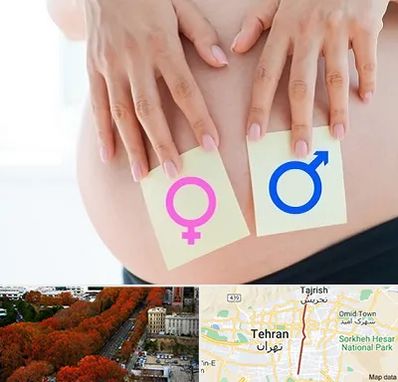 کلینیک تعیین جنسیت در ولیعصر 
