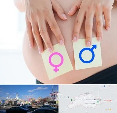 کلینیک تعیین جنسیت در ماهدشت کرج