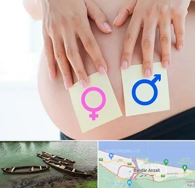 کلینیک تعیین جنسیت در بندر انزلی