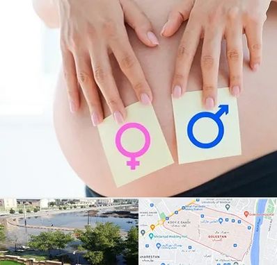 کلینیک تعیین جنسیت در گلستان اهواز