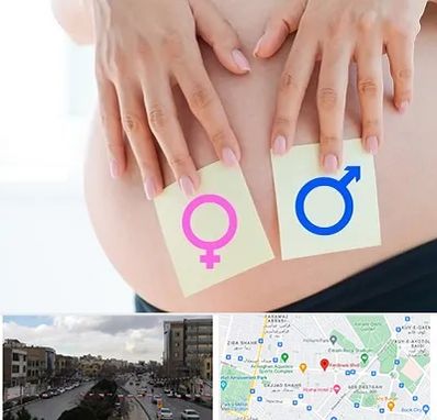 کلینیک تعیین جنسیت در بلوار فردوسی مشهد