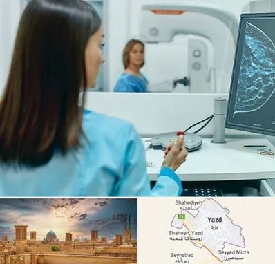 ماموگرافی در یزد