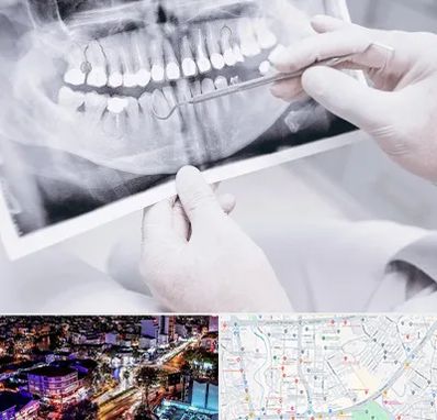 رادیولوژی دهان و دندان در منظریه رشت