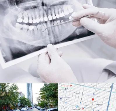 رادیولوژی دهان و دندان در امامت مشهد