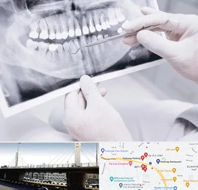رادیولوژی دهان و دندان در پارک وی 
