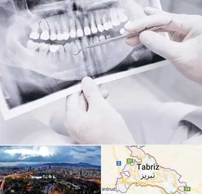 رادیولوژی دهان و دندان در تبریز