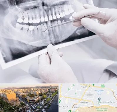 رادیولوژی دهان و دندان در تهرانپارس 