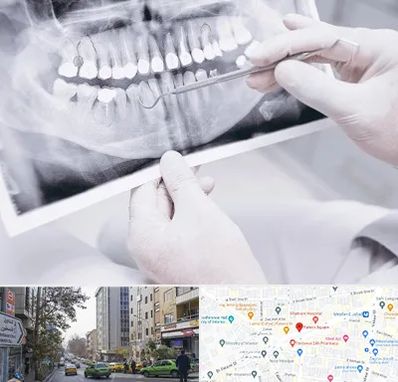 رادیولوژی دهان و دندان در فاطمی
