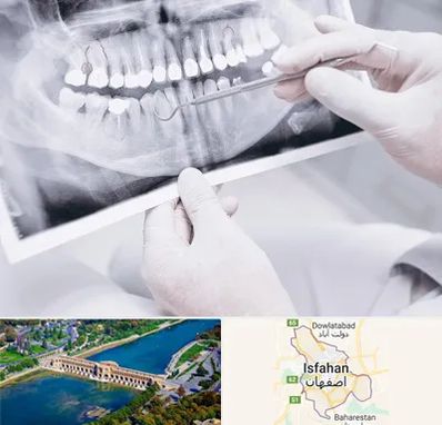 رادیولوژی دهان و دندان در اصفهان