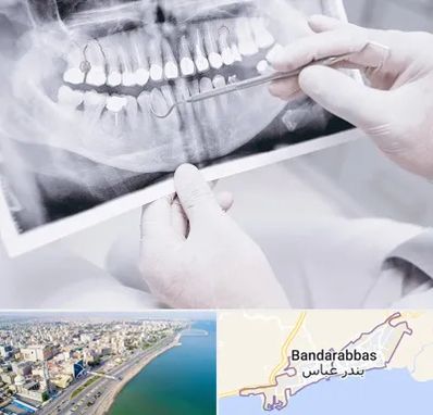 رادیولوژی دهان و دندان در بندرعباس