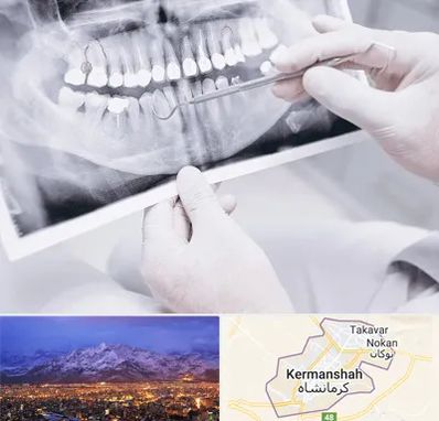 رادیولوژی دهان و دندان در کرمانشاه