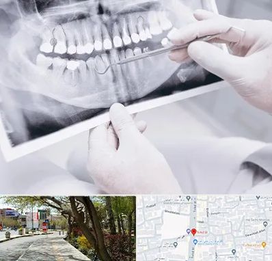 رادیولوژی دهان و دندان در خیابان توحید اصفهان