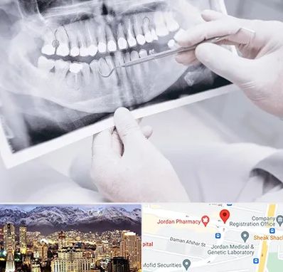 رادیولوژی دهان و دندان در جردن 