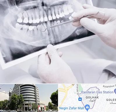 رادیولوژی دهان و دندان در قلهک 