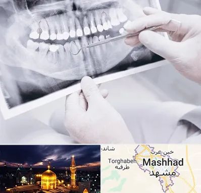 رادیولوژی دهان و دندان در مشهد