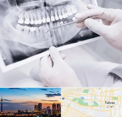 رادیولوژی دهان و دندان در غرب تهران 