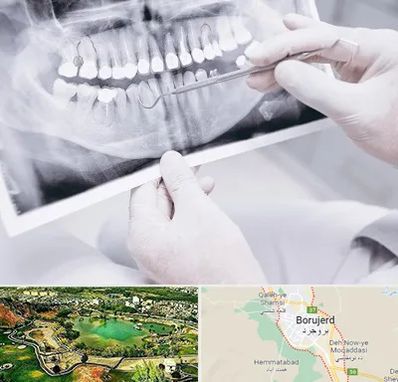 رادیولوژی دهان و دندان در بروجرد