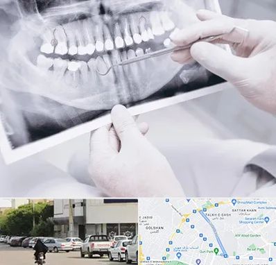 رادیولوژی دهان و دندان در قدوسی شرقی شیراز