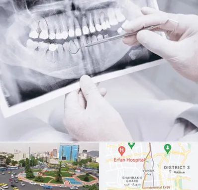 رادیولوژی دهان و دندان در ونک 