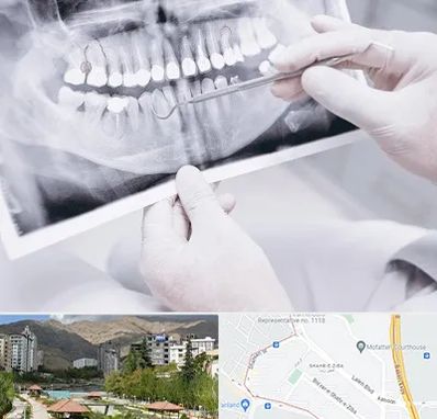 رادیولوژی دهان و دندان در شهر زیبا