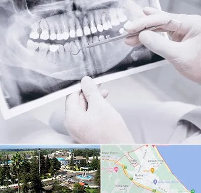 رادیولوژی دهان و دندان در رودسر