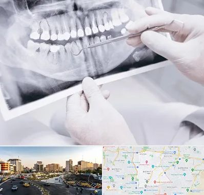 رادیولوژی دهان و دندان در منطقه 7 تهران