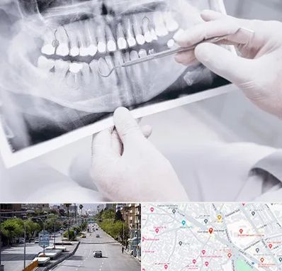 رادیولوژی دهان و دندان در خیابان زند شیراز