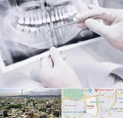 رادیولوژی دهان و دندان در گیشا 