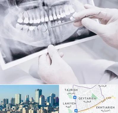 رادیولوژی دهان و دندان در قیطریه 