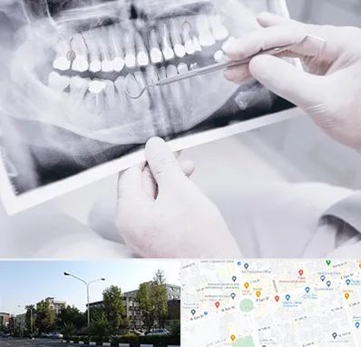 رادیولوژی دهان و دندان در میدان کاج