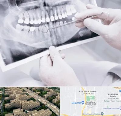 رادیولوژی دهان و دندان در اکباتان 