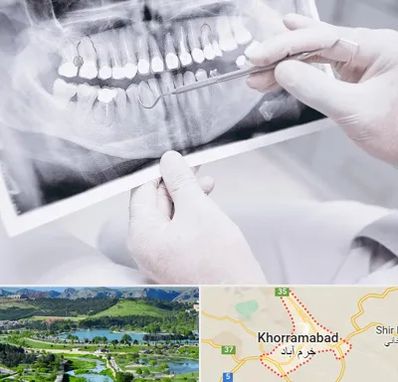 رادیولوژی دهان و دندان در خرم آباد