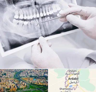 رادیولوژی دهان و دندان در اردبیل