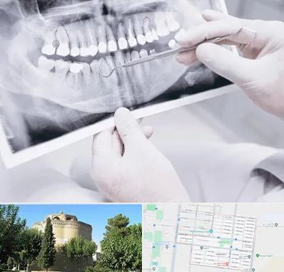 رادیولوژی دهان و دندان در مرداویج اصفهان