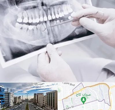 رادیولوژی دهان و دندان در سعادت آباد 