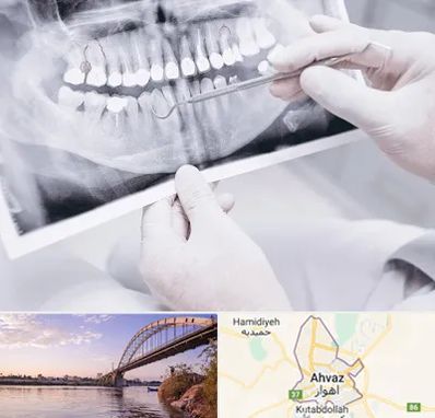 رادیولوژی دهان و دندان در اهواز