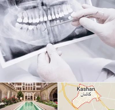 رادیولوژی دهان و دندان در کاشان