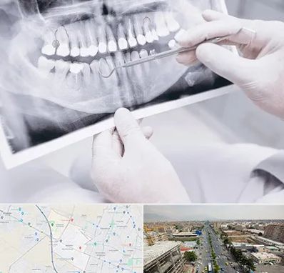 رادیولوژی دهان و دندان در حصارک کرج