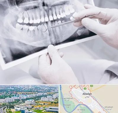 رادیولوژی دهان و دندان در آبادان