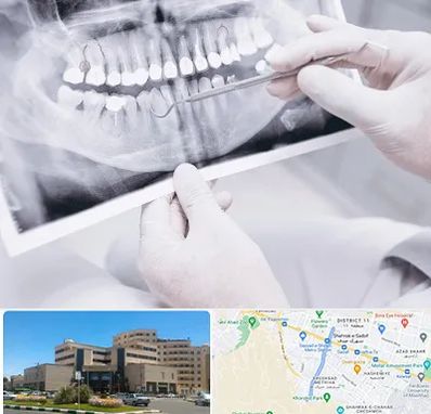 رادیولوژی دهان و دندان در صیاد شیرازی مشهد