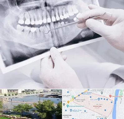 رادیولوژی دهان و دندان در گلستان اهواز