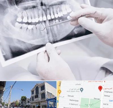 رادیولوژی دهان و دندان در افسریه 
