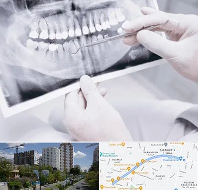 رادیولوژی دهان و دندان در اندرزگو