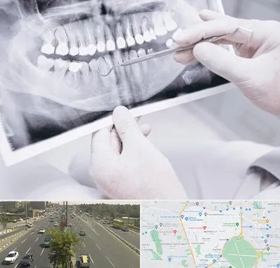 رادیولوژی دهان و دندان در منطقه 17 تهران