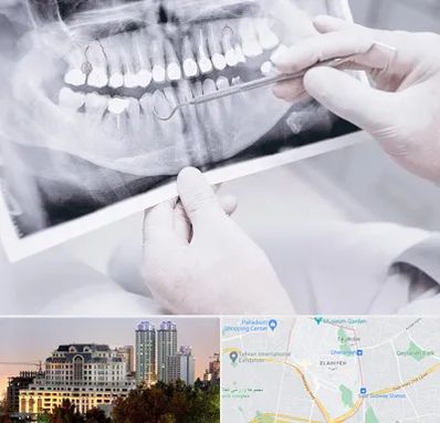 رادیولوژی دهان و دندان در فرشته 