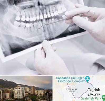 رادیولوژی دهان و دندان در زعفرانیه 