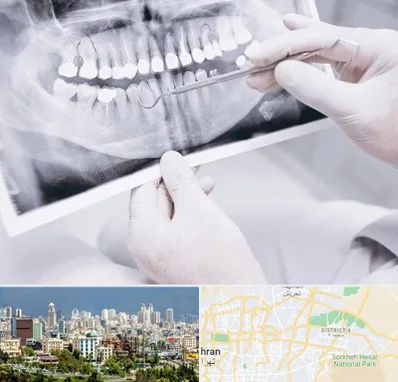 رادیولوژی دهان و دندان در شرق تهران 